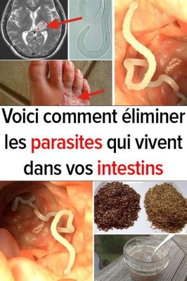  Distome: Un Parasite Subtil Qui S'Installe Dans Vos Intestins!