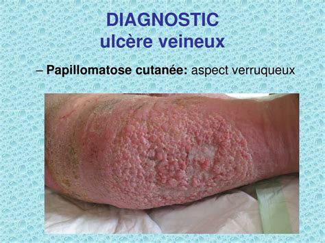  Illacme Plurinodis : Un Délice Subterrain aux Jambes Infinies !